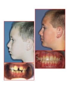 Changing Smiles, Changing Lives-oc-2019-pic orig-232x300