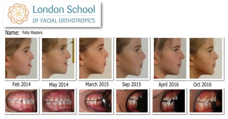 Comp.Pr .MastersPolly1-768x404