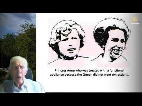 John-Mews-lectures-part-13-contrasting-orthodontic-concepts